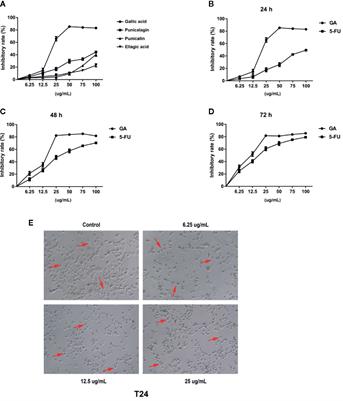 Gallic Acid Inhibits Bladder Cancer T24 Cell Progression Through Mitochondrial Dysfunction and PI3K/Akt/NF-κB Signaling Suppression